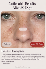 Spenix Wrinkle Retreat Pro LED Face Mask | Red Light Therapy