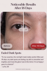 Spenix Wrinkle Retreat Pro LED Face Mask | Red Light Therapy