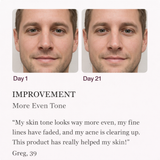 Spenix Wrinkle Retreat Pro LED Face Mask | Red Light Therapy