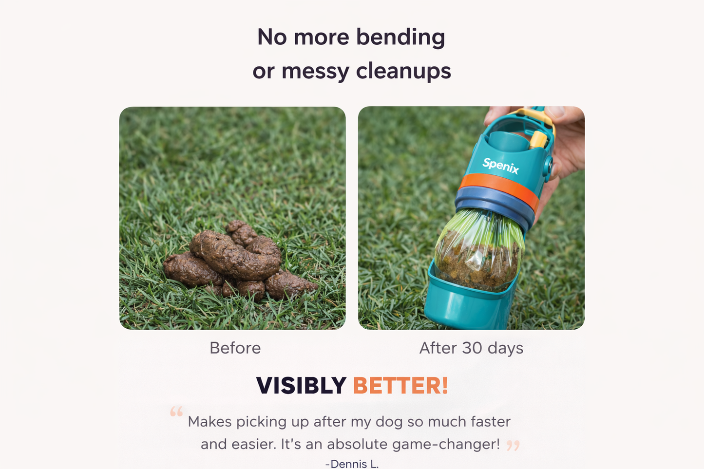 Spenix Dog Pooper Scooper – Hands-Free Cleaner with Bags