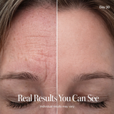 Spenix Wrinkle Retreat Pro LED Face Mask | Red Light Therapy