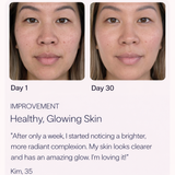 Spenix 4-in-1 Skincare Wand – Red Light Therapy Device