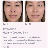 Spenix 4-in-1 Skincare Wand – Red Light Therapy Device